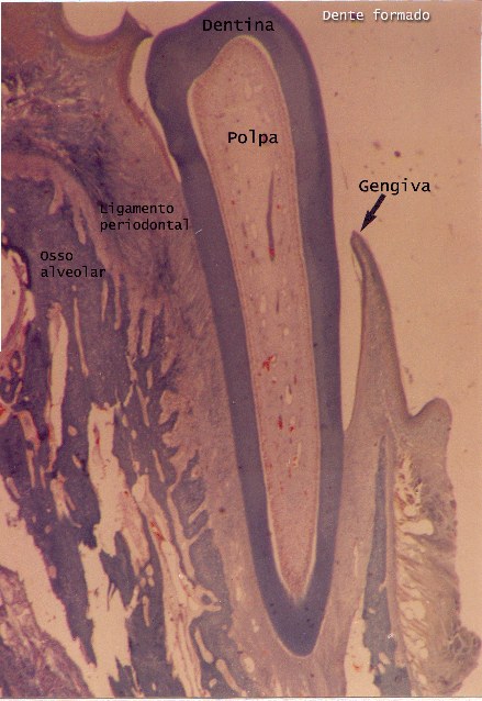 Dente formado (descalcificado) - tricrômico