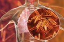 Tuberculose.jpg