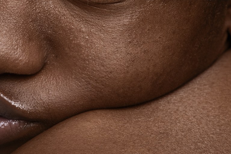 INSCRIÇÕES ABERTAS PARA O PRIMEIRO PRÊMIO L’ORÉAL DERMATOLOGIA MAIS INCLUSIVA