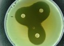 Pesquisadores da UFPB desenvolvem espuma dental antimicrobiana, cicatrizante e analgésica