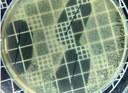 Pesquisadores da UFPB desenvolvem fio de sutura antimicrobiano