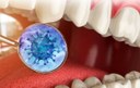 UFPB capacita dentistas de 167 cidades paraibanas para prevenir Covid-19