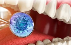 Durante a pandemia, a saúde bucal deve ser preservada, já que uma das portas principais de entrada do novo coronavírus é pela boca. Crédito: Domo Odontologia